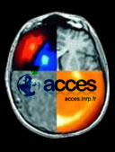 access