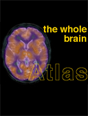the-whole-brain